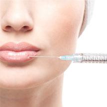 Mărire buze cu Acid Hialuronic
